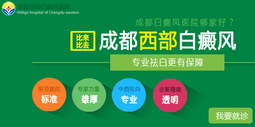 成都白癜风哪个医院好