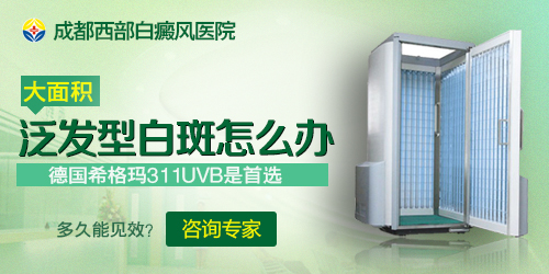 成都白癜风哪个医院好