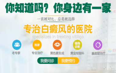 成都白癜风哪个医院好