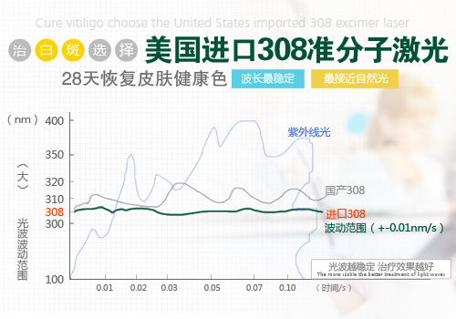 成都白癜风哪个医院好